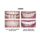 DISILICATO LITIO CAD HT C14 5 UD. OFERTA 5+1 - EVOLITH